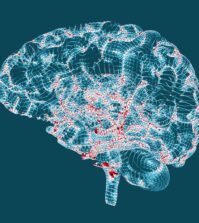 Alzheimer - boala fara remediu